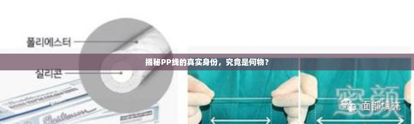 揭秘PP線的真實身份，究竟是何物？